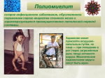 Полиомиелит – это вирусное инфекционное заболевание, поражающее нервную систему и вызывающее полный паралич.